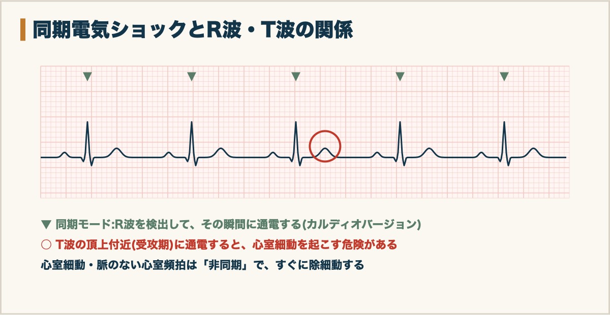 同期電気ショックとR波・T波の関係
