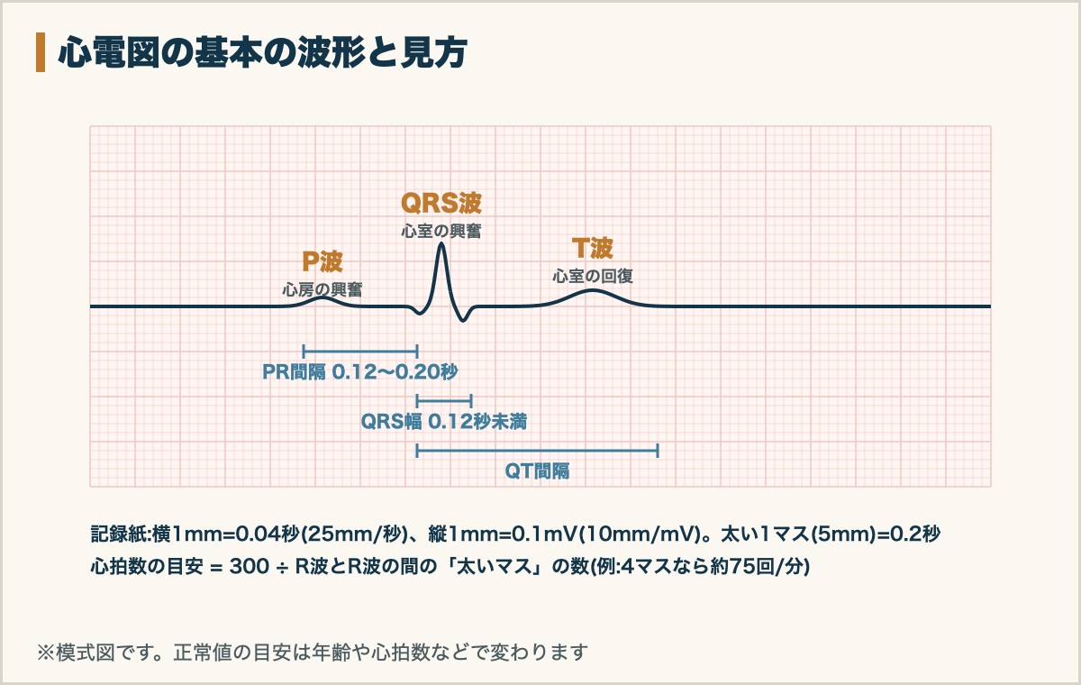 心電図の基本の波形と見方