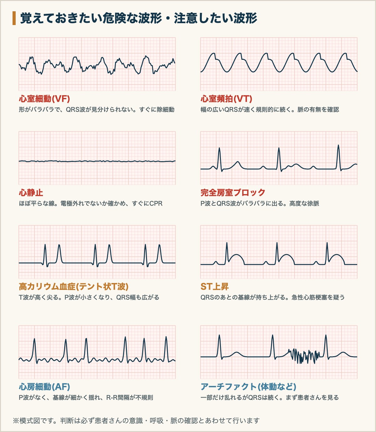 覚えておきたい危険な波形・注意したい波形