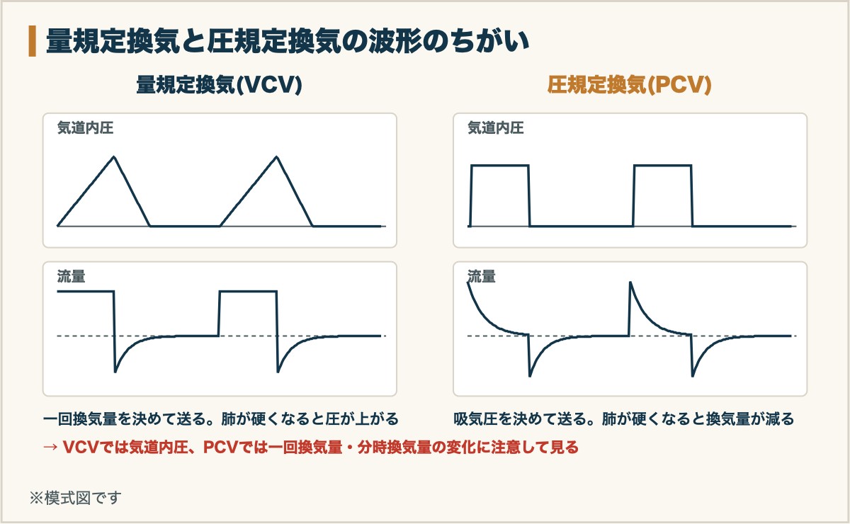 量規定換気と圧規定換気の波形のちがい